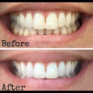 AP24 Whitening Toothpaste